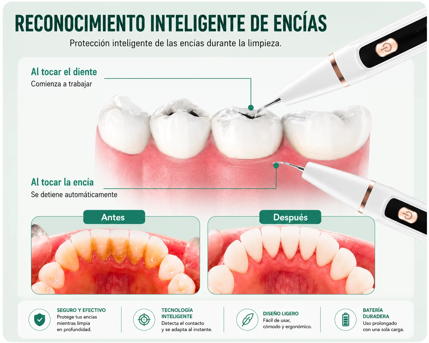 Tecnología de reconocimiento inteligente de encías