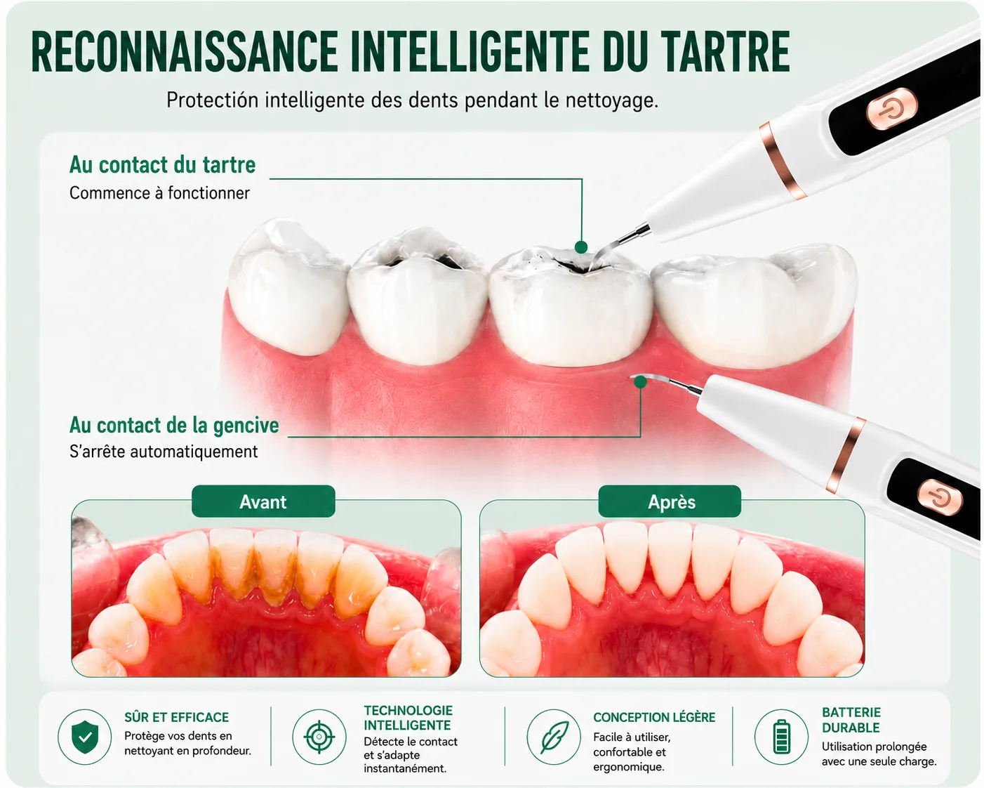 Tecnología de reconocimiento inteligente de encías