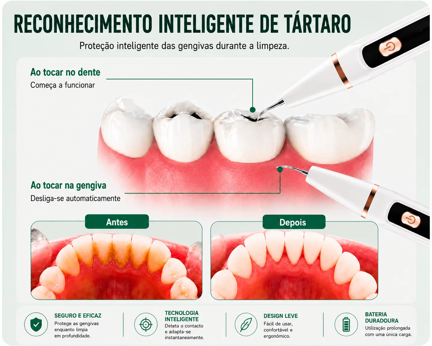 Tecnología de reconocimiento inteligente de encías